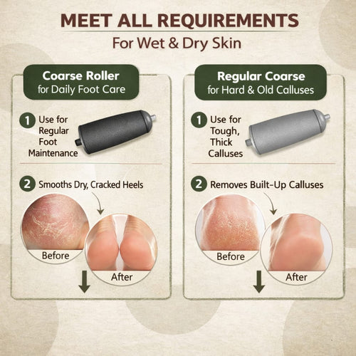 Callus remover